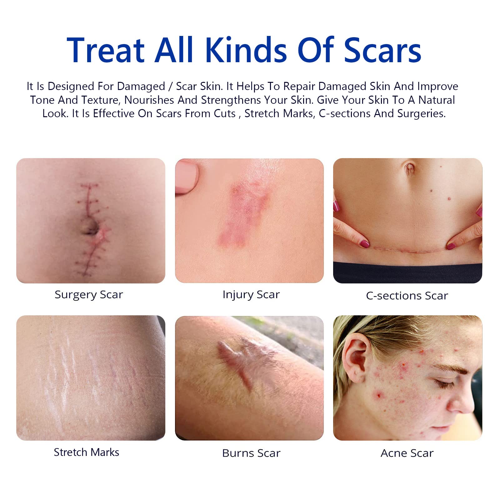 SBHEANGBA Scar Cream packaging highlighting silicone gel formula and safety