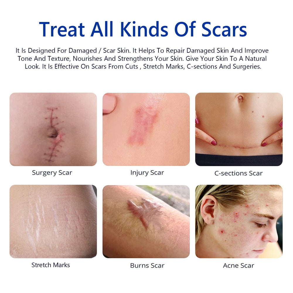 SBHEANGBA Scar Cream packaging highlighting silicone gel formula and safety