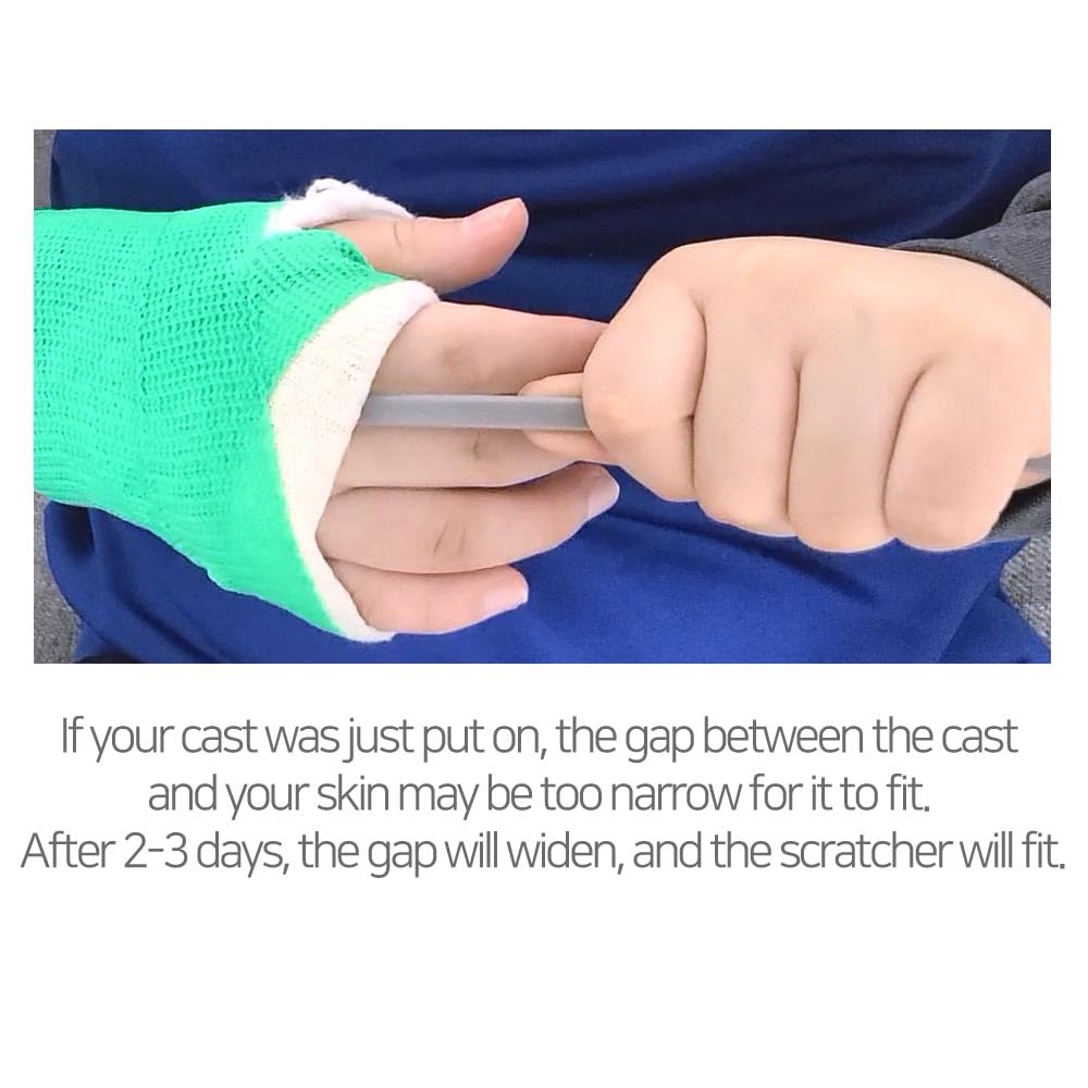 SC Scratch N Clean 17-inch tool for comfortable cast care.