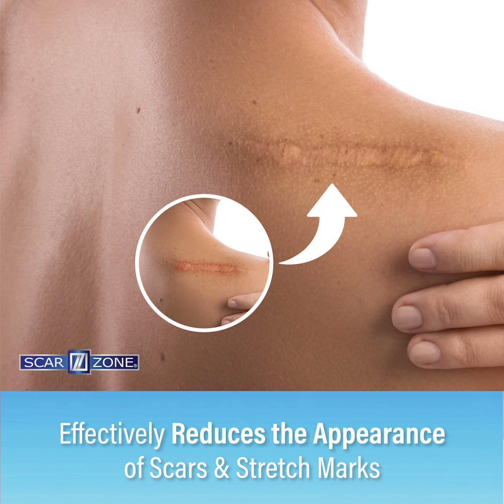 SCAR ZONE Advanced Scar Cream with dimethicone for lasting moisture on skin.