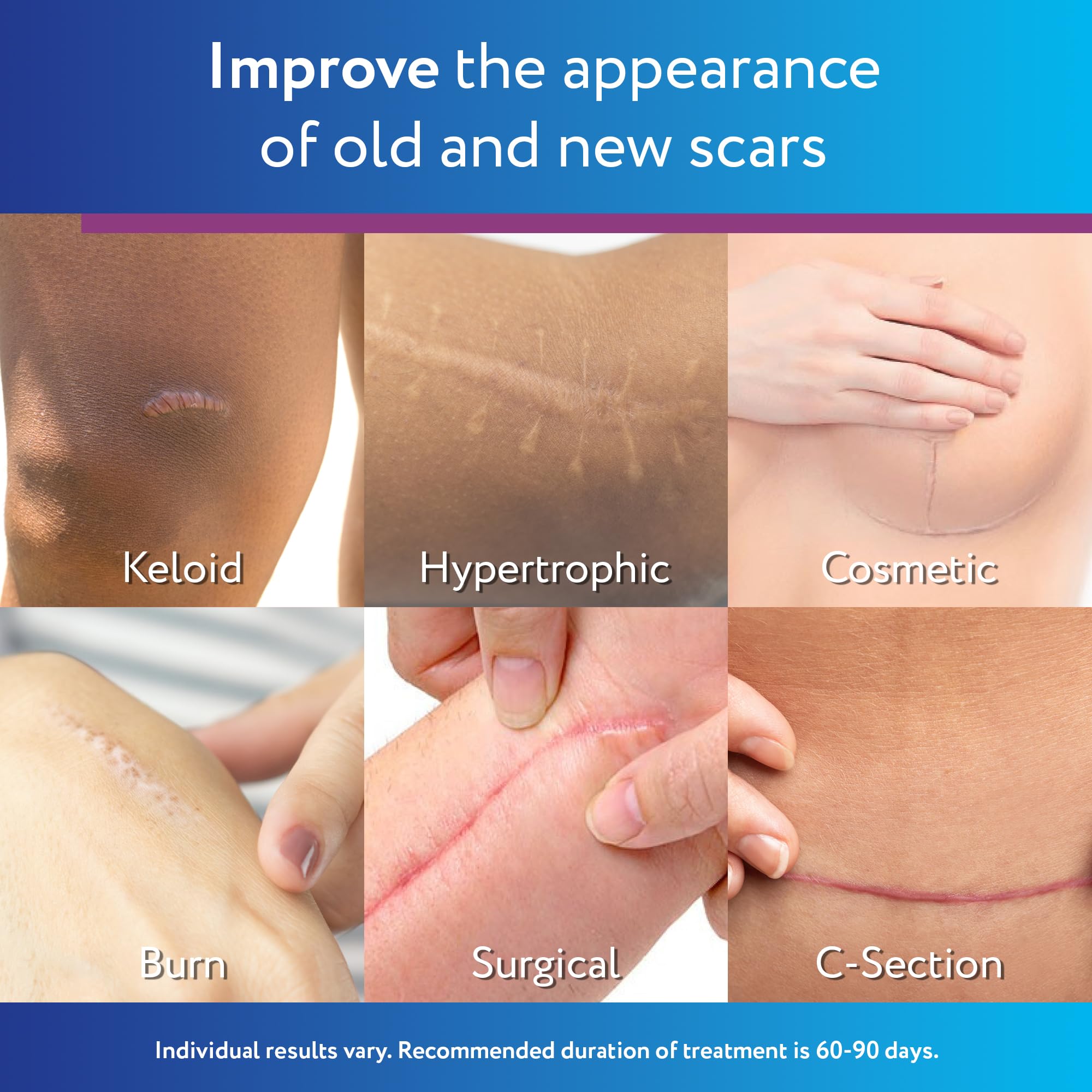 Applying ScarAway on the face demonstrates easy, thin coating for daily use.
