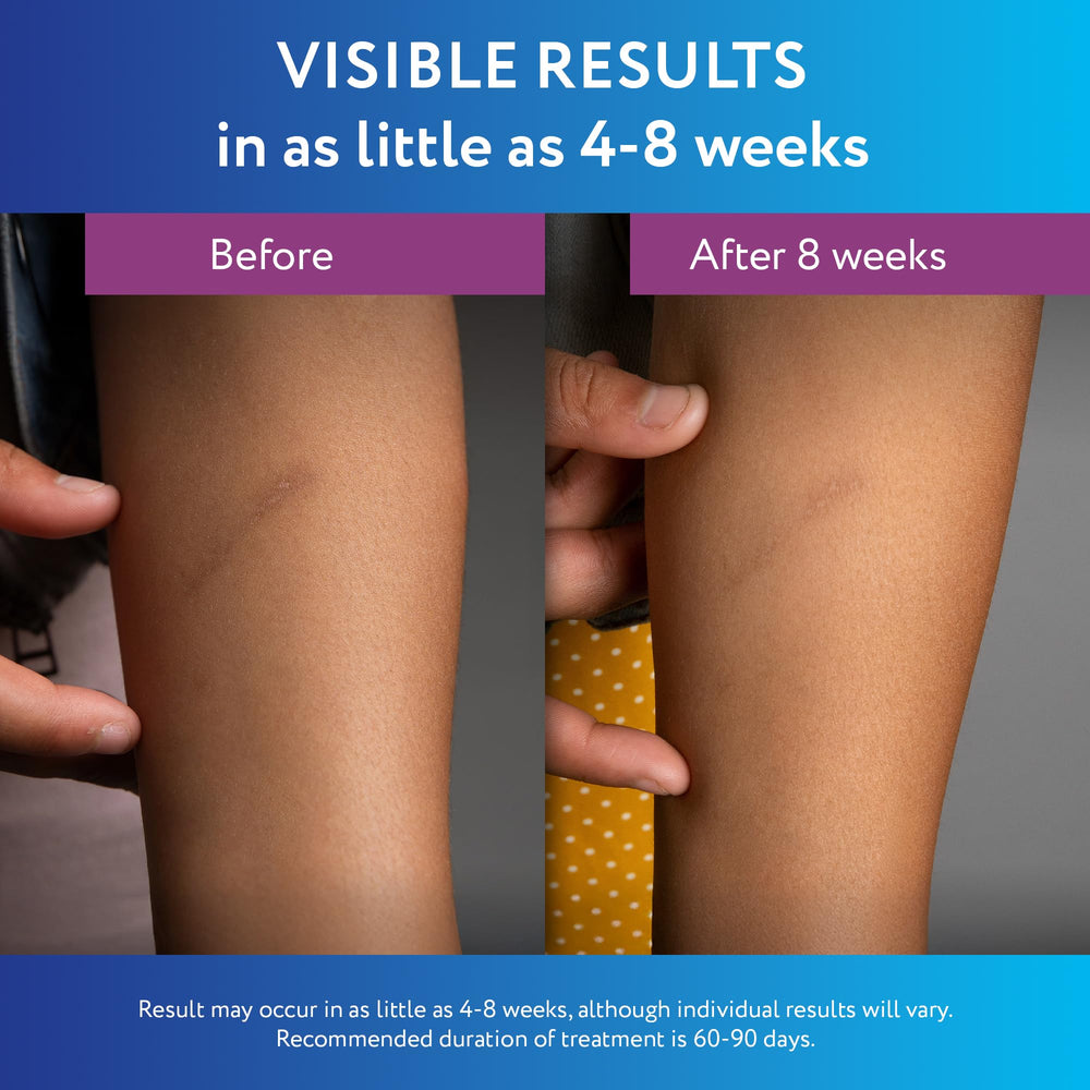 ScarAway gel on scar area reduces visibility with consistent use.
