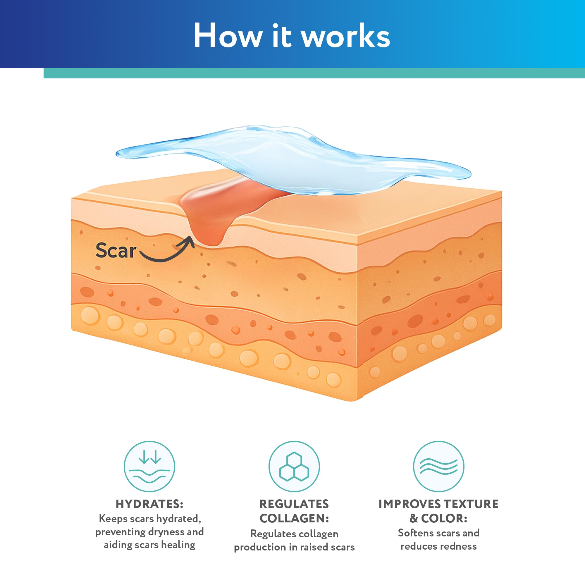ScarAway silicone gel suitable for sensitive skin users seeking comfort
