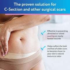 ScarAway breathable silicone scar sheet, flexible for comfortable contouring.