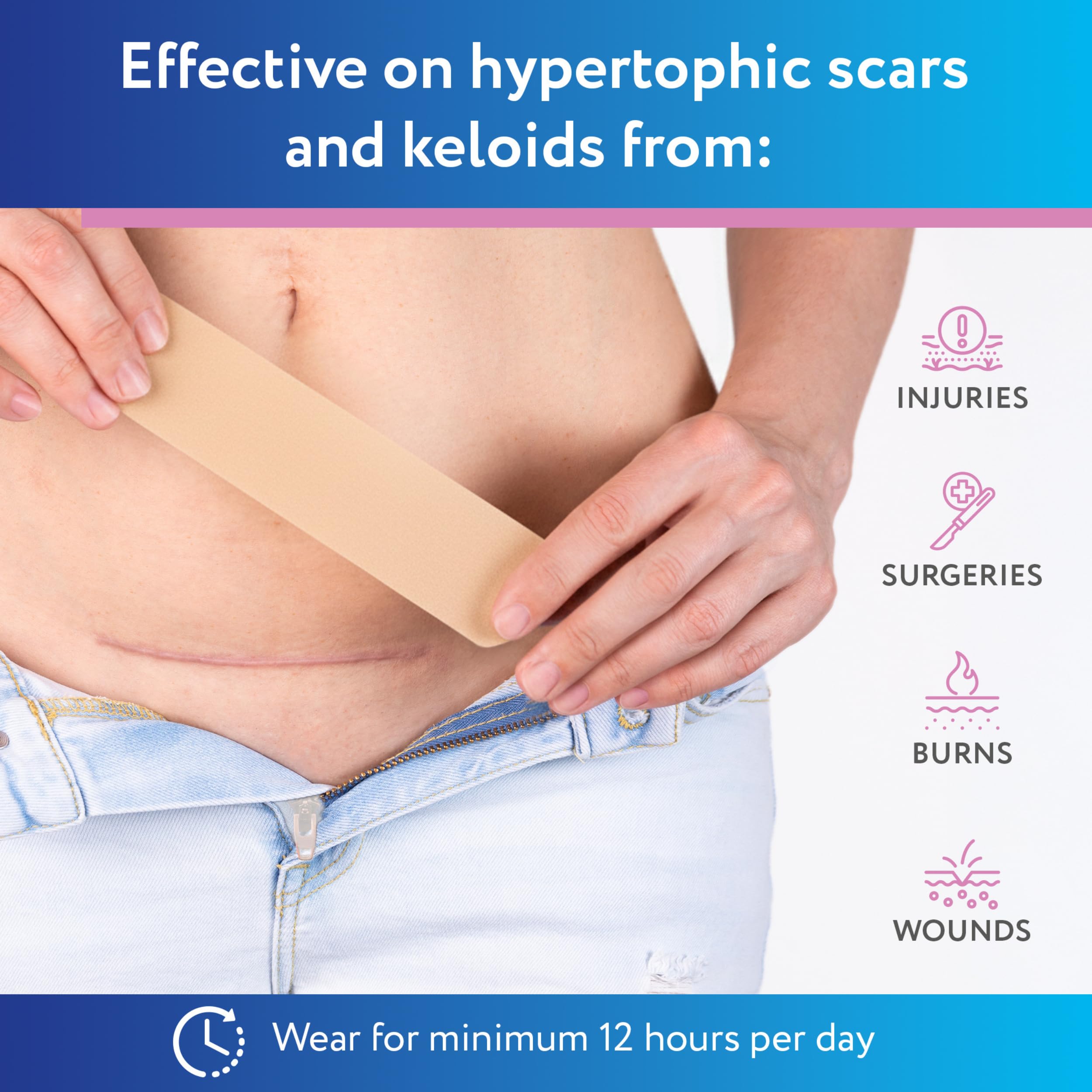 ScarAway silicone scar sheet, easy application and removal.