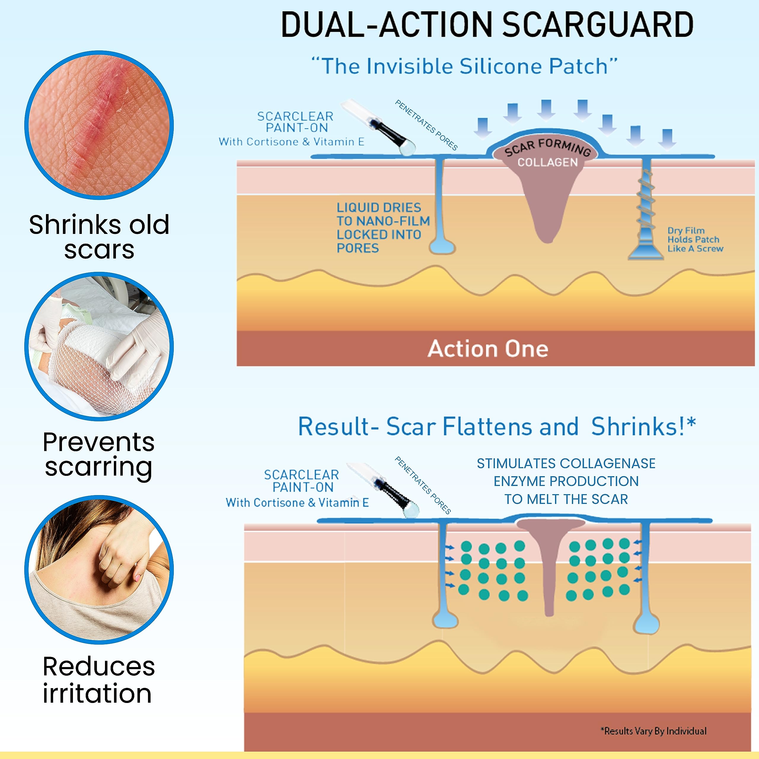 ScarGuard provides a flexible, discreet layer for ongoing scar management.