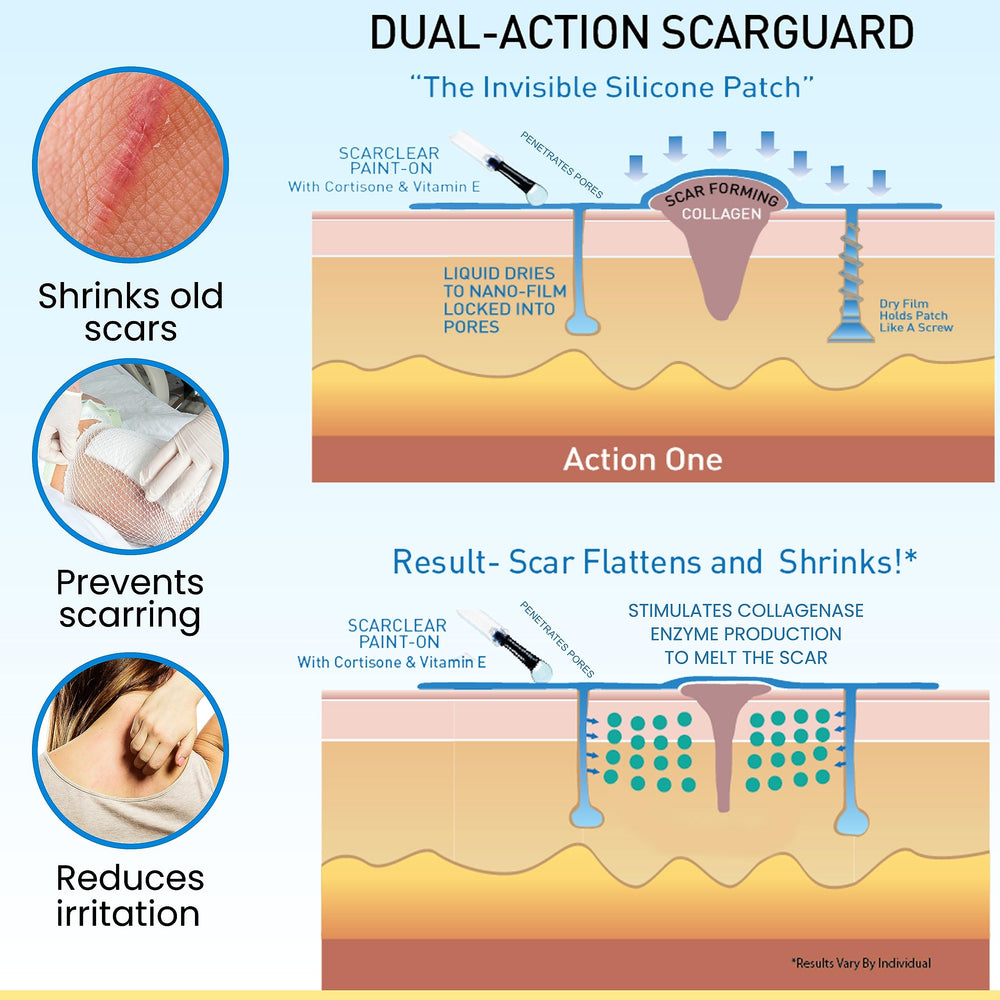 ScarGuard provides a flexible, discreet layer for ongoing scar management.