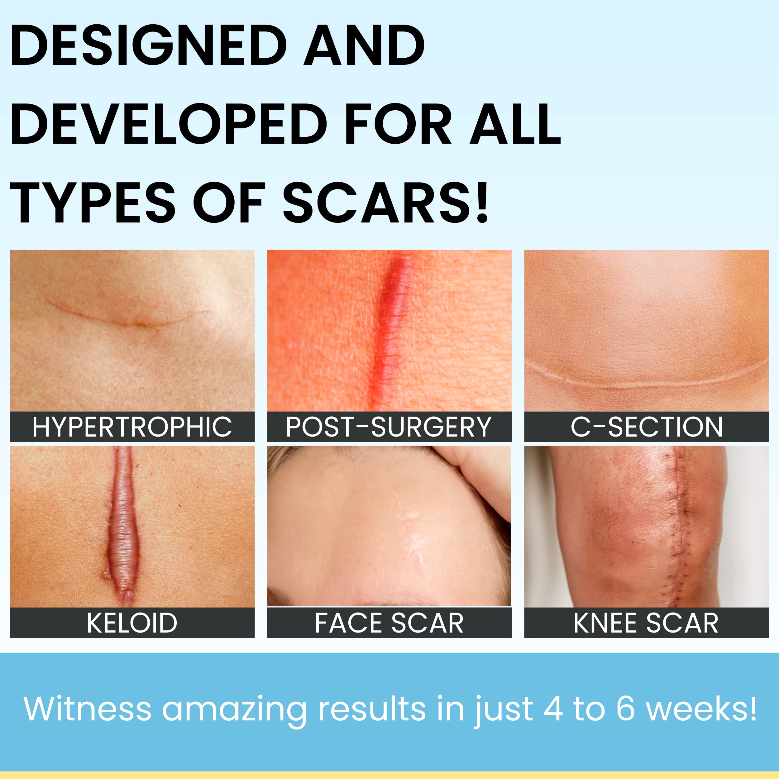 ScarGuard dries in seconds to an invisible nano-sheet over healed skin.