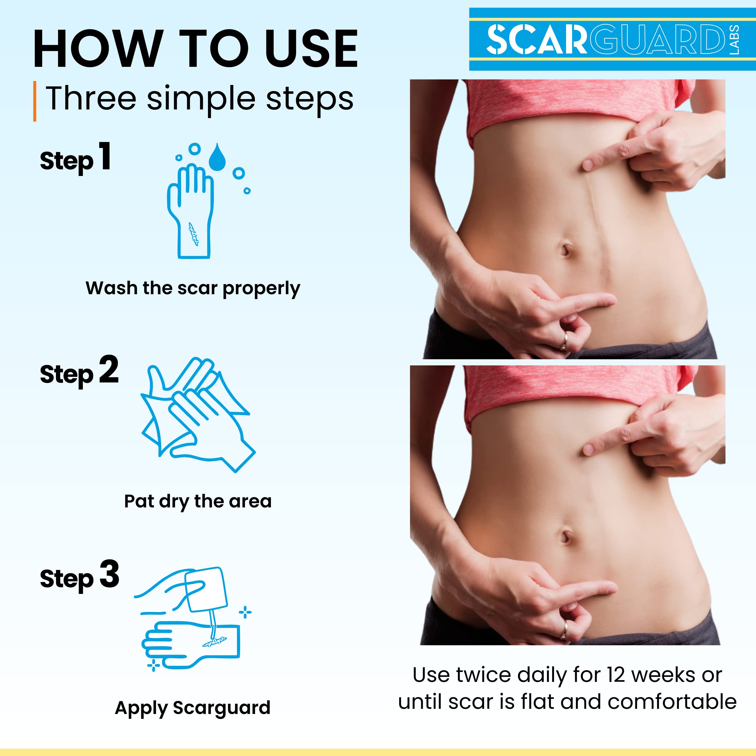 ScarGuard brush-on liquid avoids skin irritation and mess.