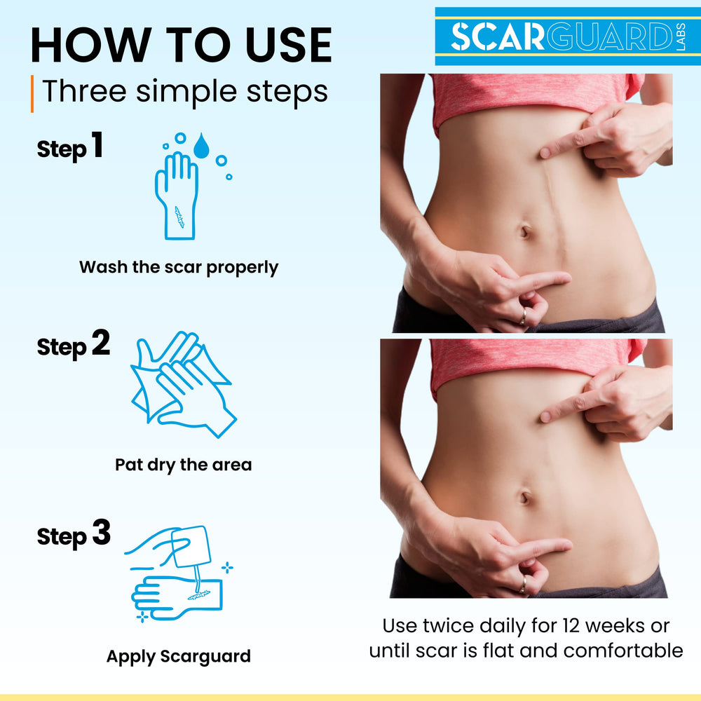 ScarGuard brush-on liquid avoids skin irritation and mess.