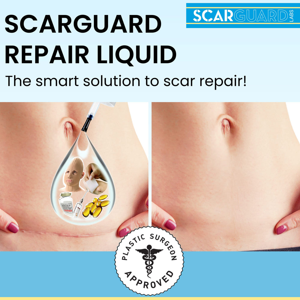 ScarGuard delivers vitamin E with silicone for balanced scar care.