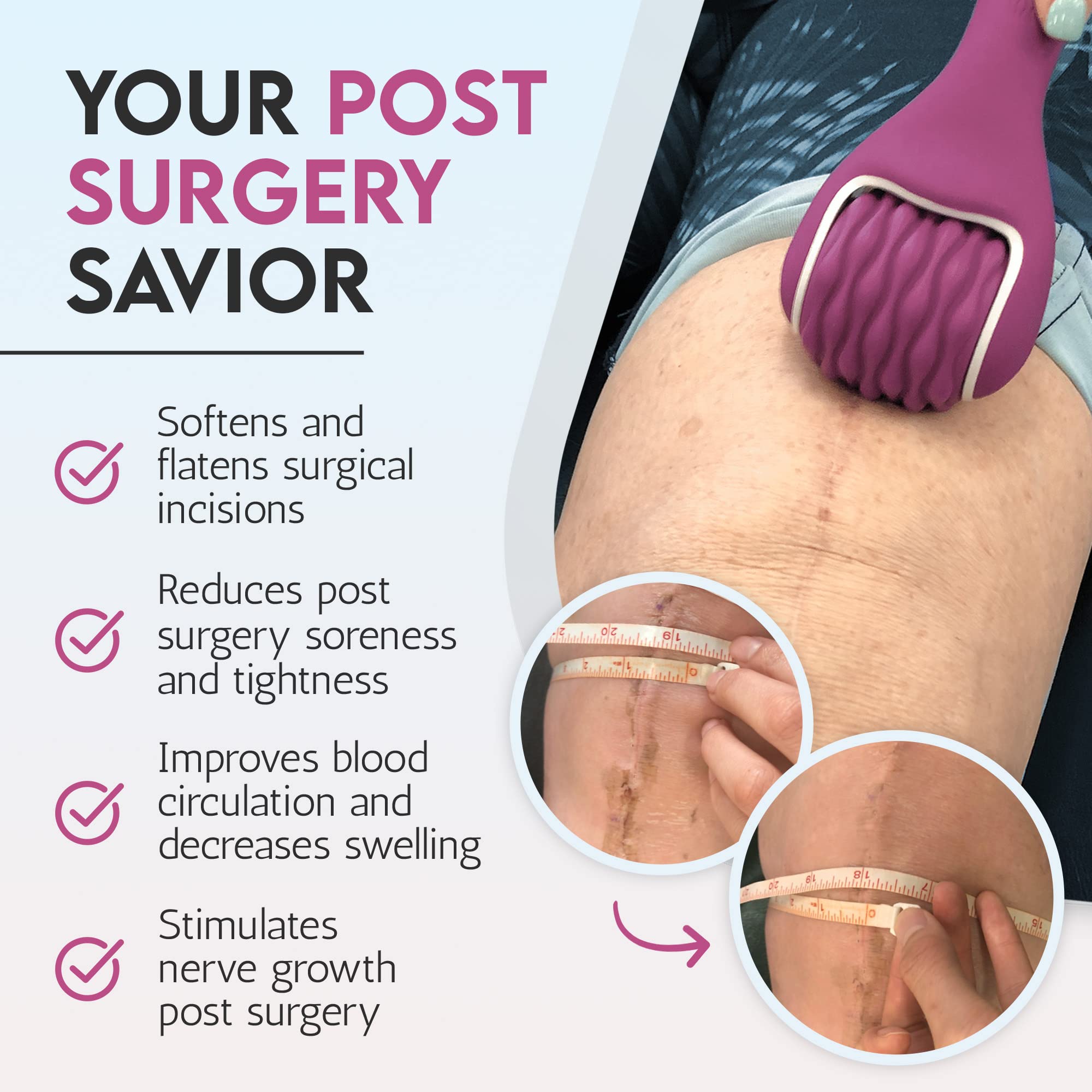 Scarroller vibration supports nerve sensation rebound during recovery.