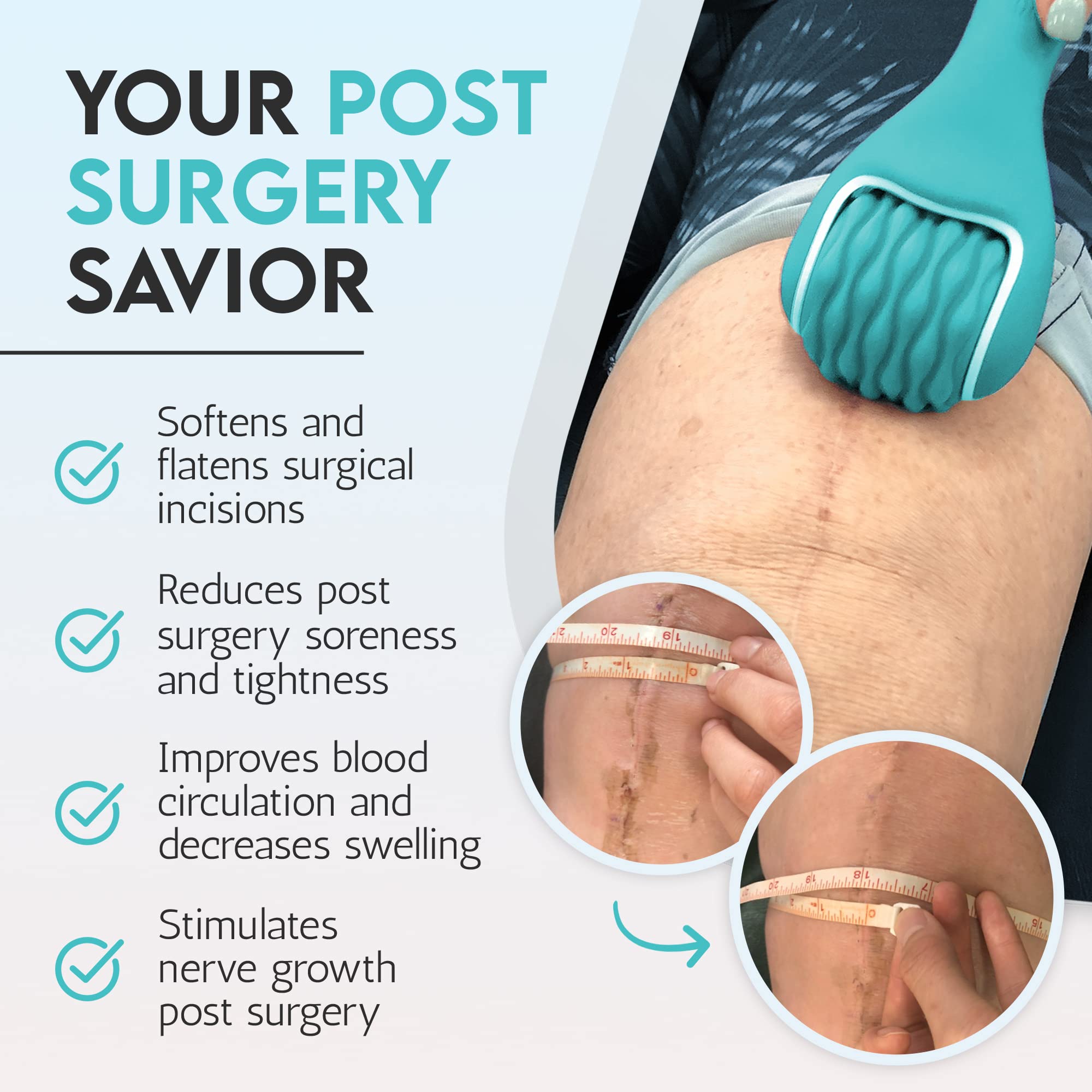 scarroller silicone-textured-roller gliding over skin for comfortable post-op use