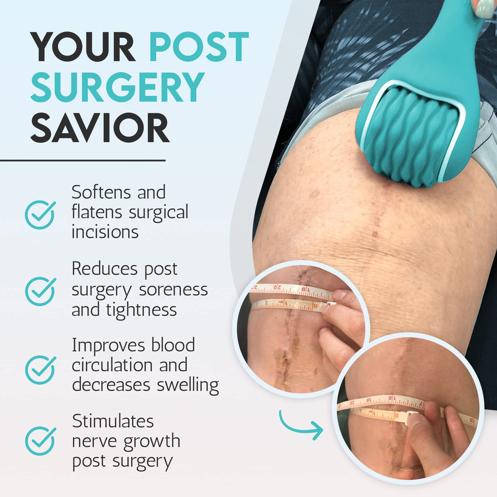 scarroller silicone-textured-roller gliding over skin for comfortable post-op use