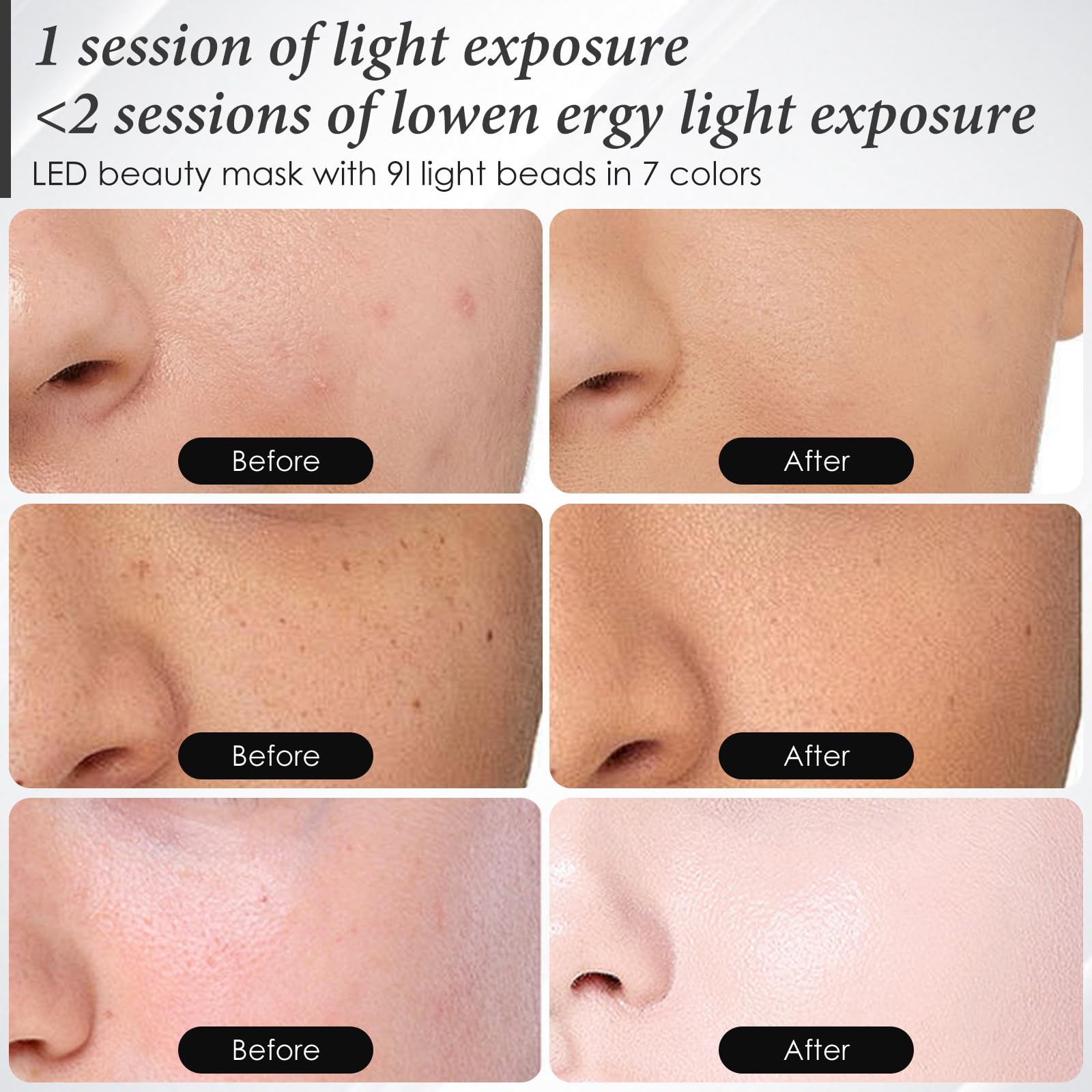 SDKWDH Red Light Mask silicone comfort material for extended sessions.