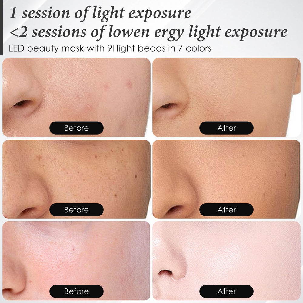 SDKWDH Red Light Mask silicone comfort material for extended sessions.