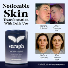 Seraph acne supplement packaging front highlighting clean ingredients.