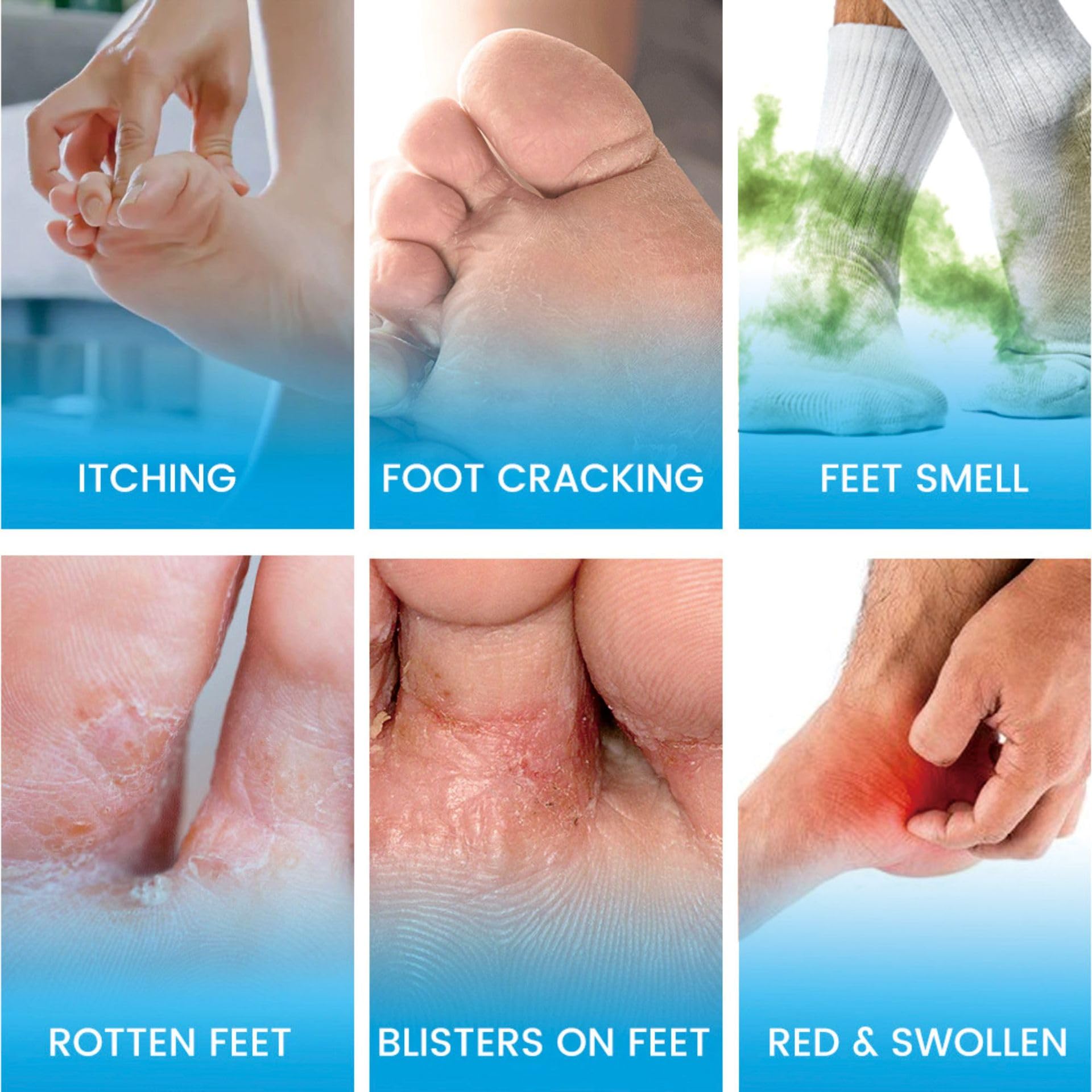 SERYNTH Foot Odor Probiotic Spray pack shot emphasizing odor control benefits.