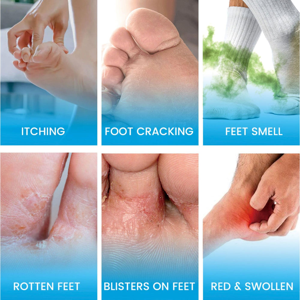 SERYNTH Foot Odor Probiotic Spray pack shot emphasizing odor control benefits.