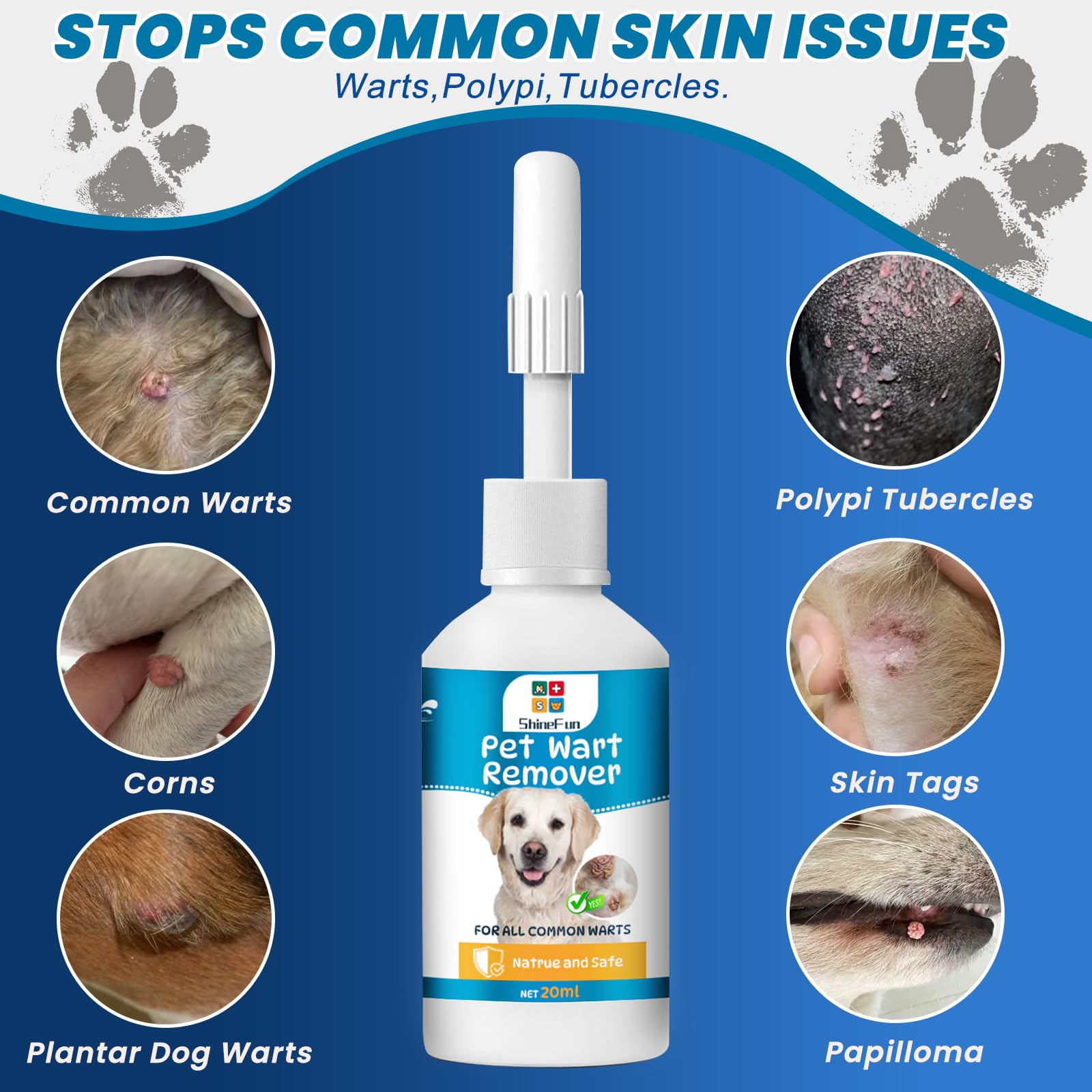 ShineFun easy-application tips for twice-daily use on warts.