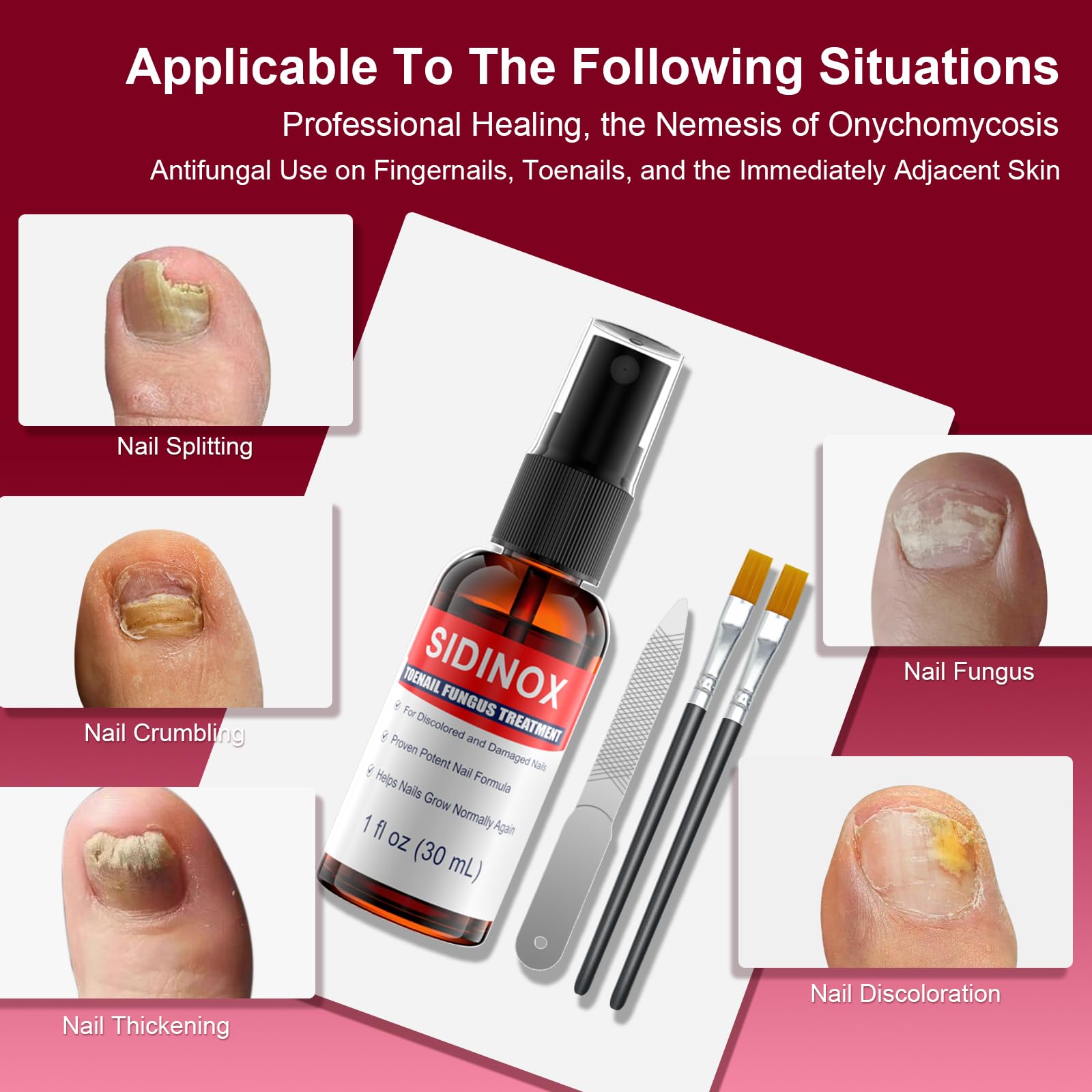 Sidinox tratamiento hongo uñas, aplicador con cepillo para cubrir toda la uña