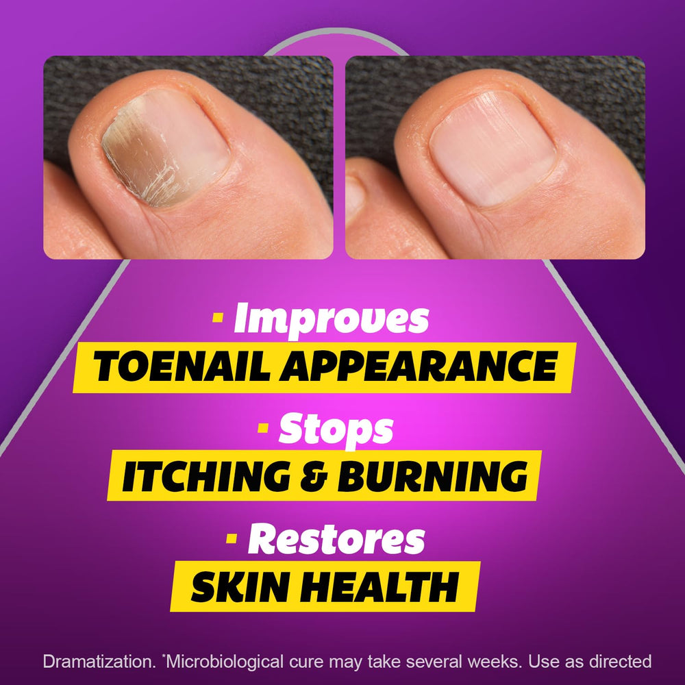 Thin layer applied around the nail cuticle using the brush.