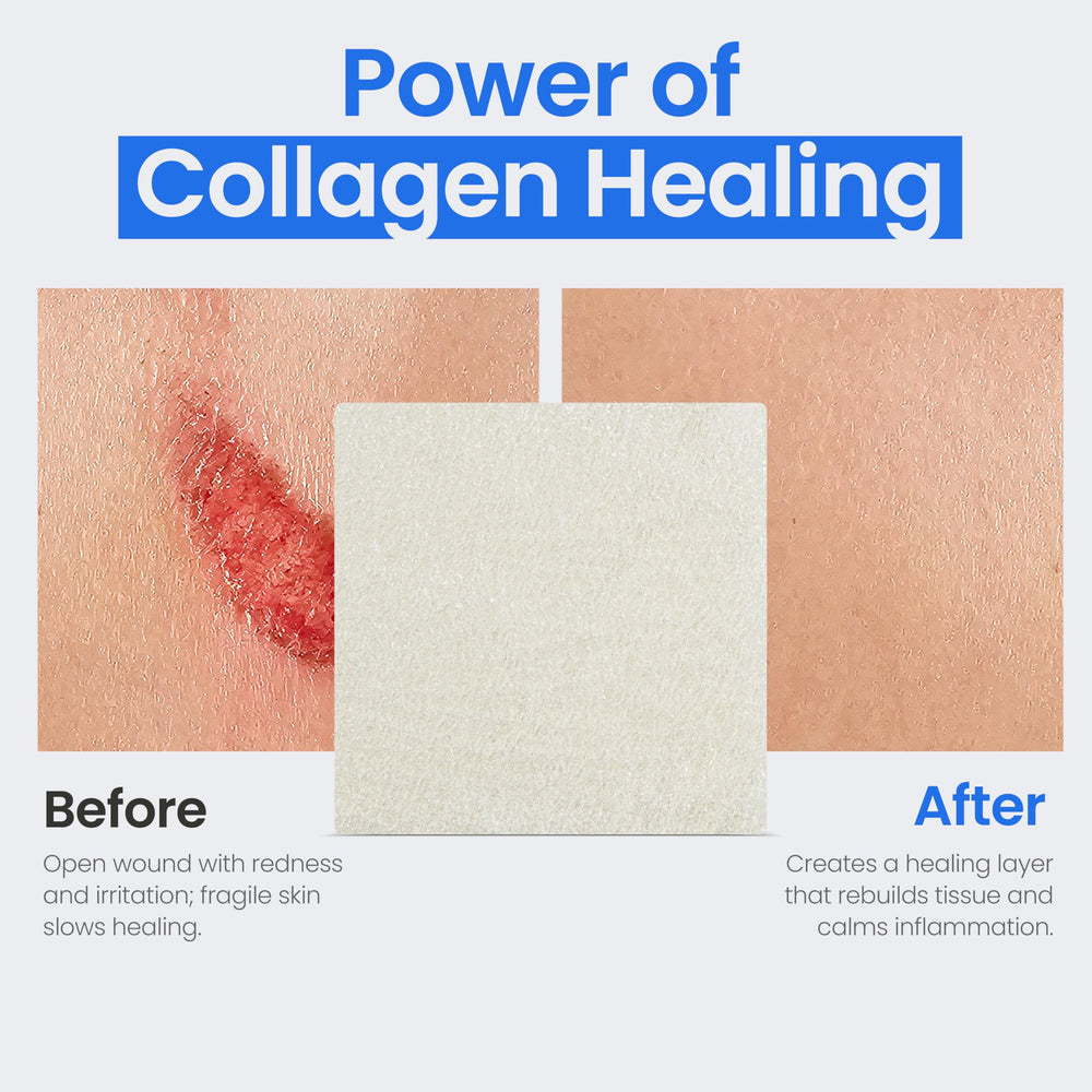Simpurity collagen dressing 5-pack supports convenient at-home wound care.