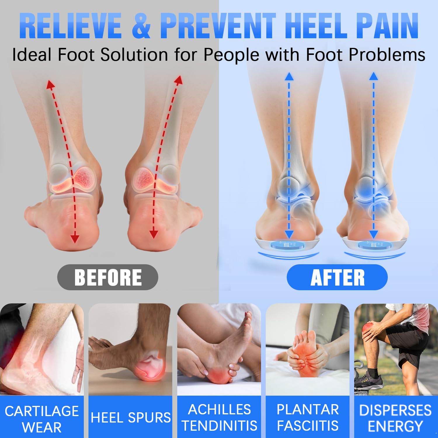Sinbowl heel cups with adhesive back for secure placement.