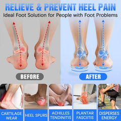 Sinbowl heel cups with adhesive back for secure placement.