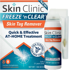 Skin Clinic Freeze 'n Clear bottle ready for at-home skin tag treatment.