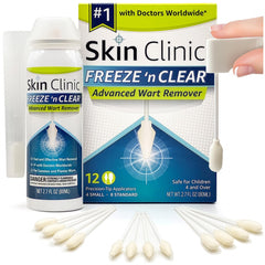 Skin Clinic Freeze 'n Clear kit box ready for at-home wart removal treatment.