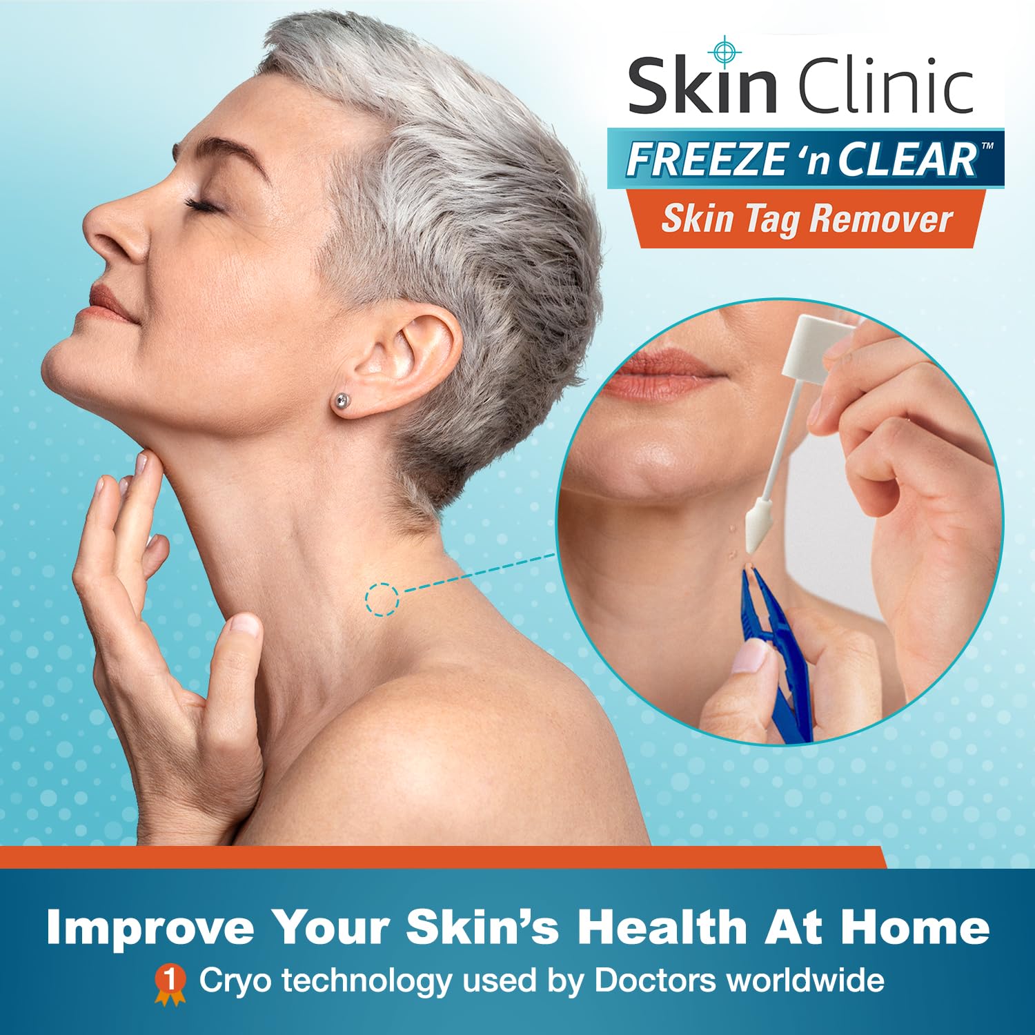 Skin Clinic Freeze 'n Clear precision applicator 1 for targeted skin tag freezing.