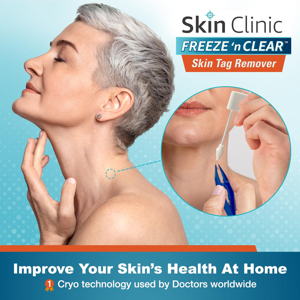 Skin Clinic Freeze 'n Clear precision applicator 1 for targeted skin tag freezing.