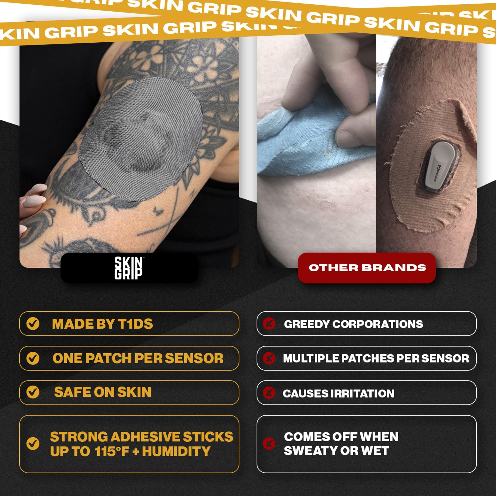 Skin Grip latex-free adhesive reduces irritation during CGM use.