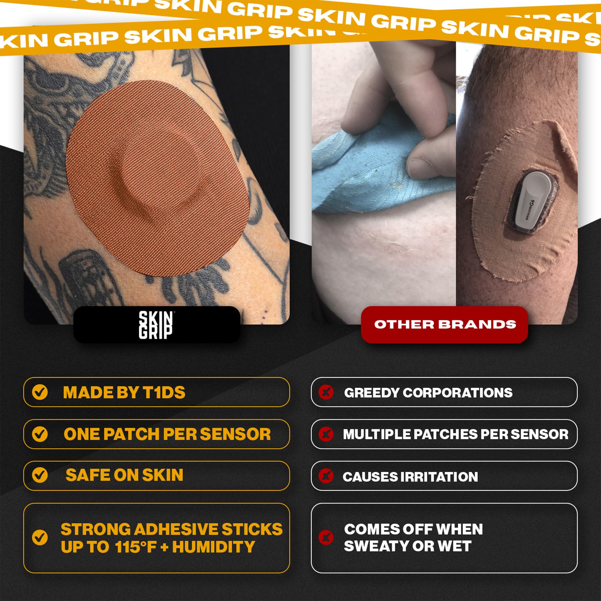 Dermatologist-friendly adhesive for sensitive skin with breathable material