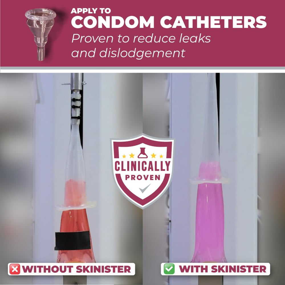 Skinister adhesive dropper securing an ostomy bag with skin protection.