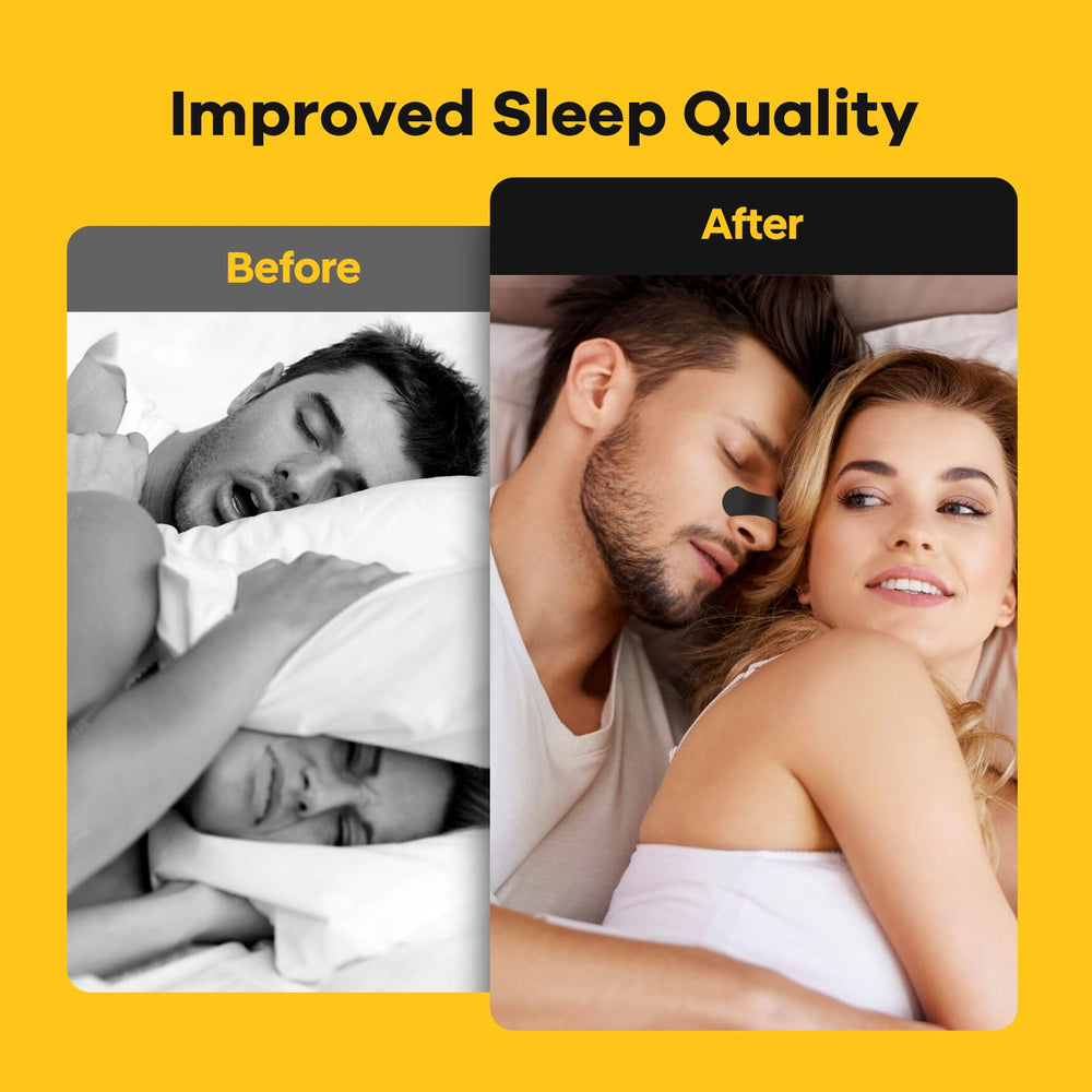 SleepSloth tiras nasales-ajuste-universal se adaptan a diversos perfiles nasales