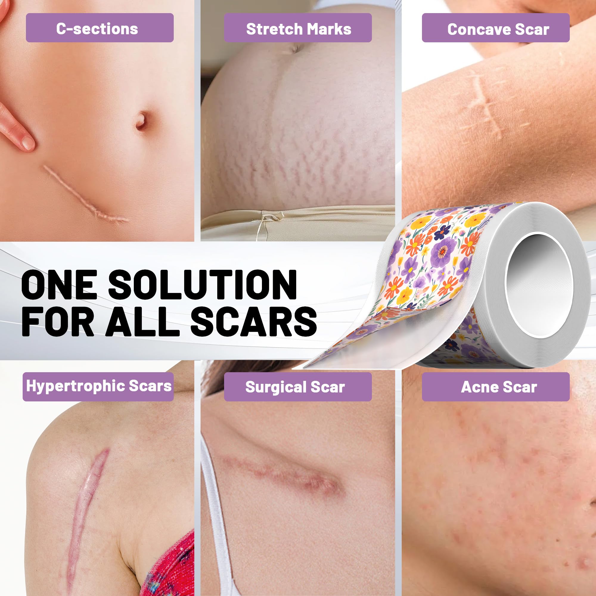 SLGCBL easy-peel scar sheet being removed gently