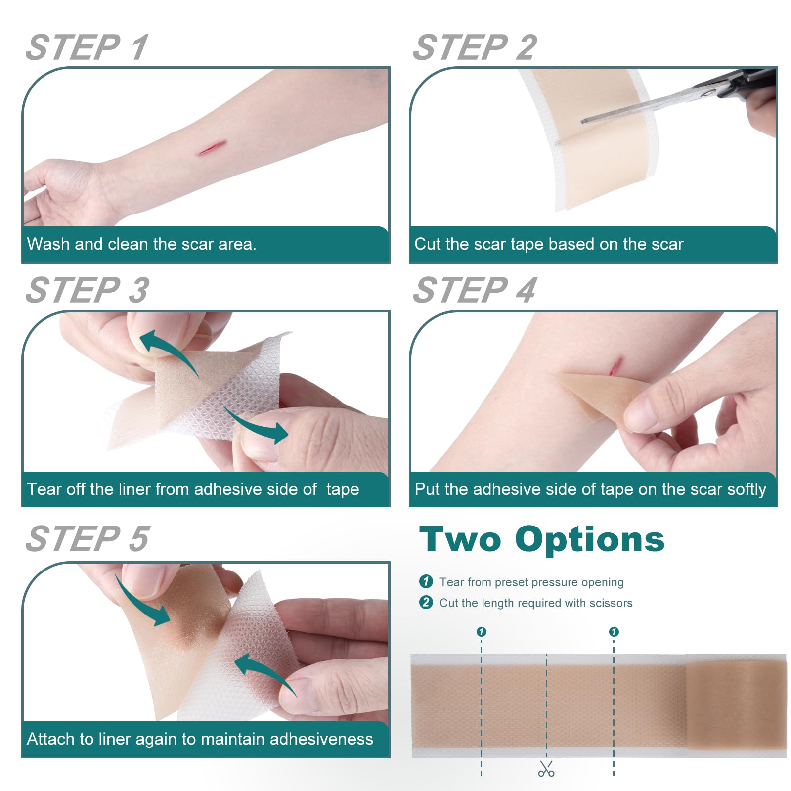 SLUKHIG scar tape on C-section area provides protection and irritation reduction.