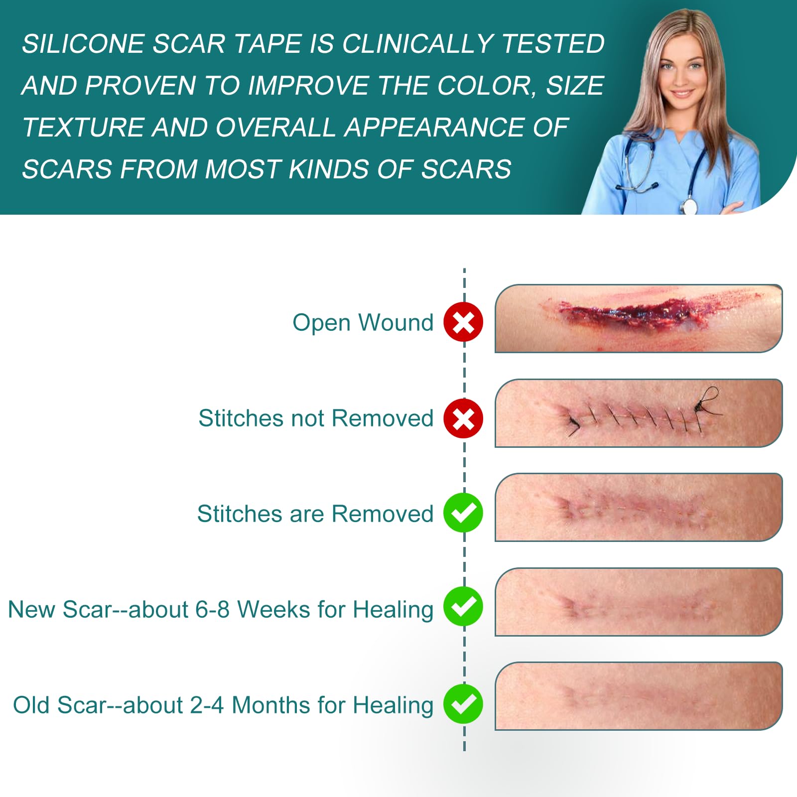 SLUKHIG silicona para cicatrices: uso seguro tras cesárea y otros tipos de cicatrices.
