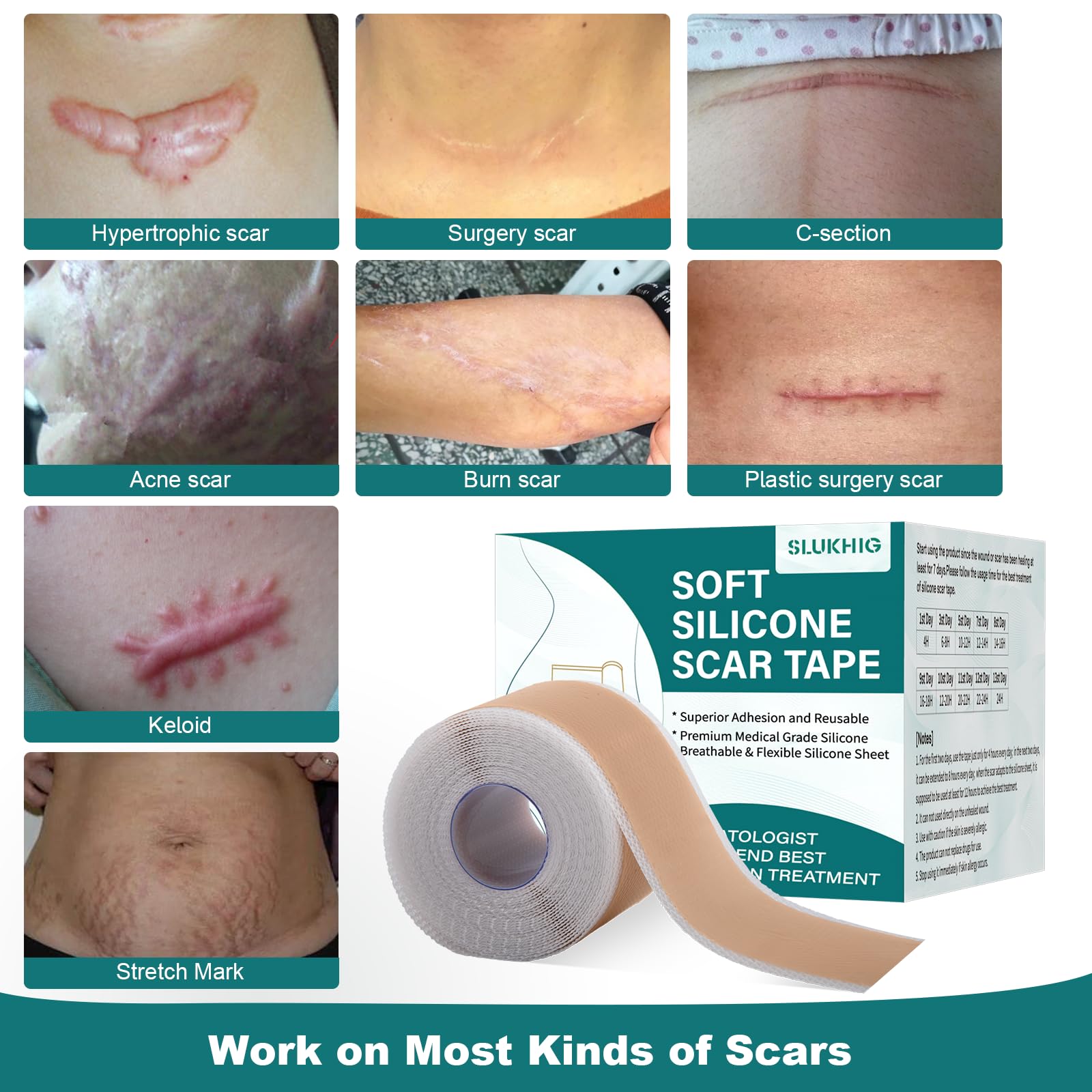 SLUKHIG silicone scar tape application demonstrates strong adhesion while remaining comfortable.