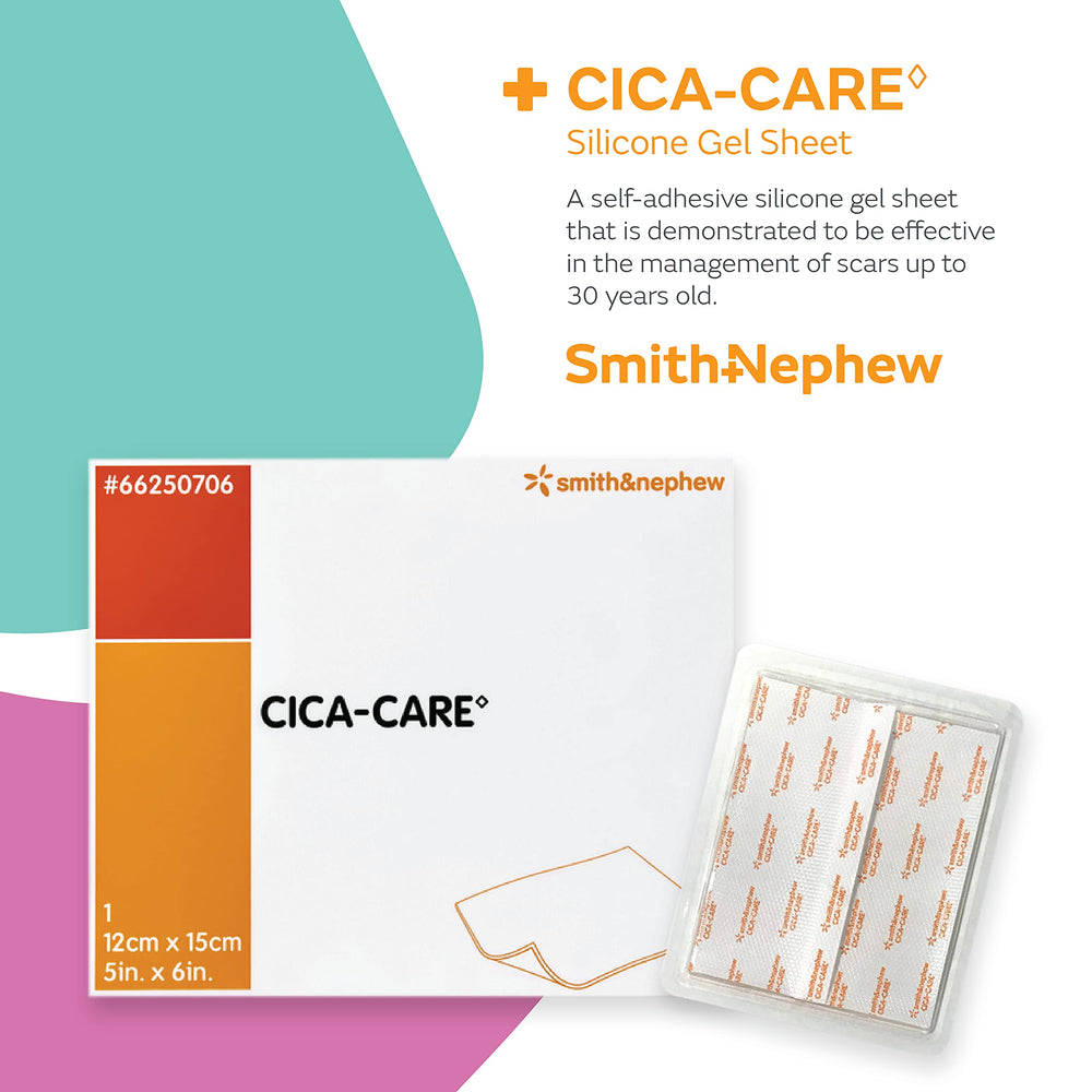 Applying CICA-Care to a scar for flattening and color reduction.