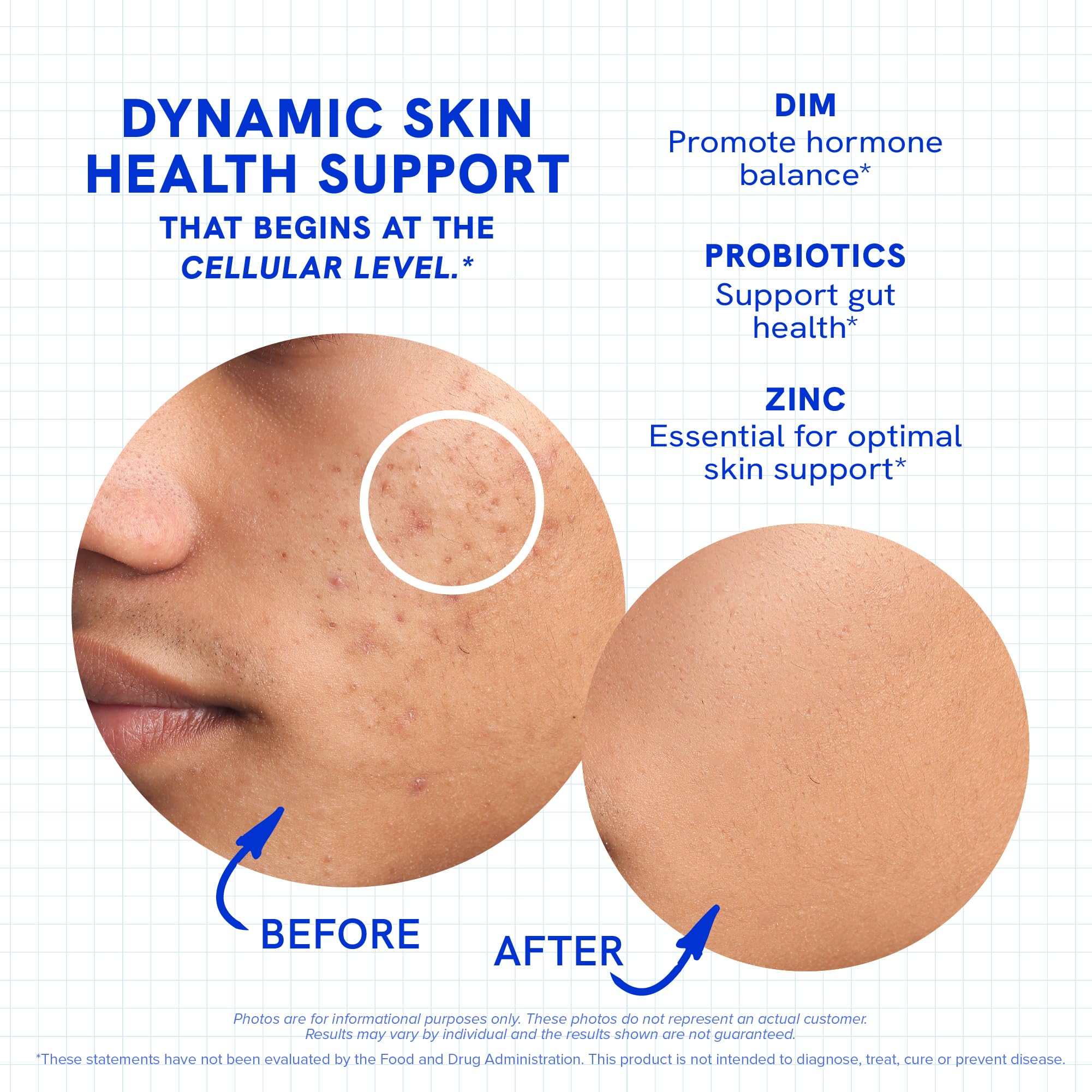 SMNutrition DIM illustration emphasizing hormone balance for healthier-looking skin