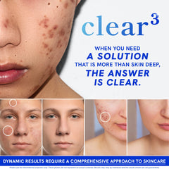 SMNutrition Clear Skin pills daily dose close-up for routine consistency
