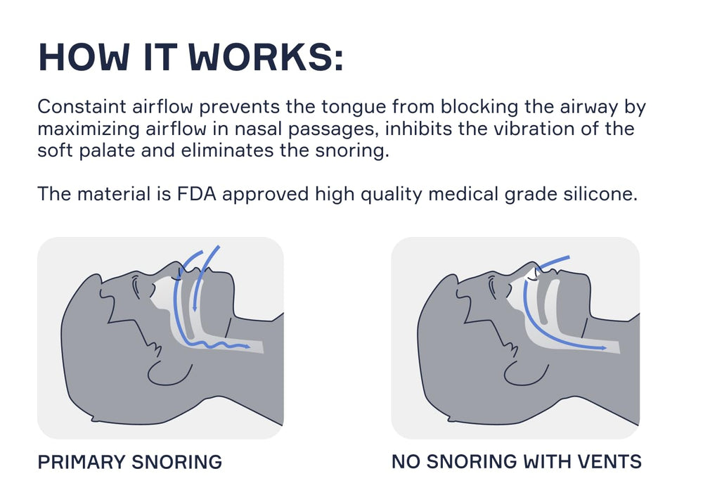 Snore Bastion nasal dilators packaging open, ideal for travel snoring relief.