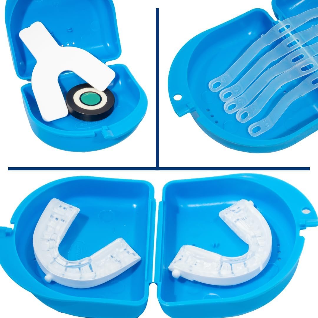 SnoreLessNow Somnofit-S even pressure system promotes secure, even night-long support.
