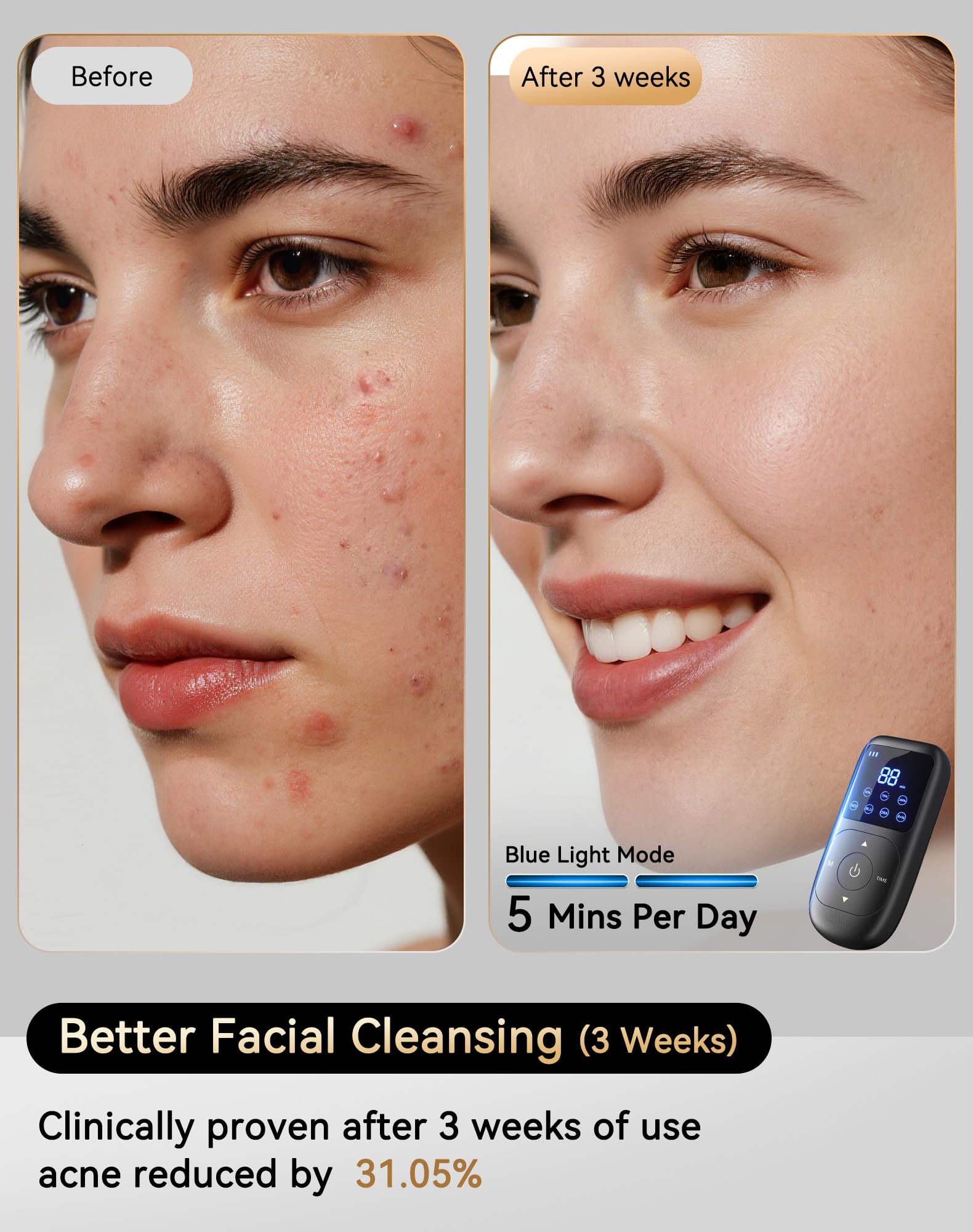 Sobetuar infrared light at 850nm penetrating skin.