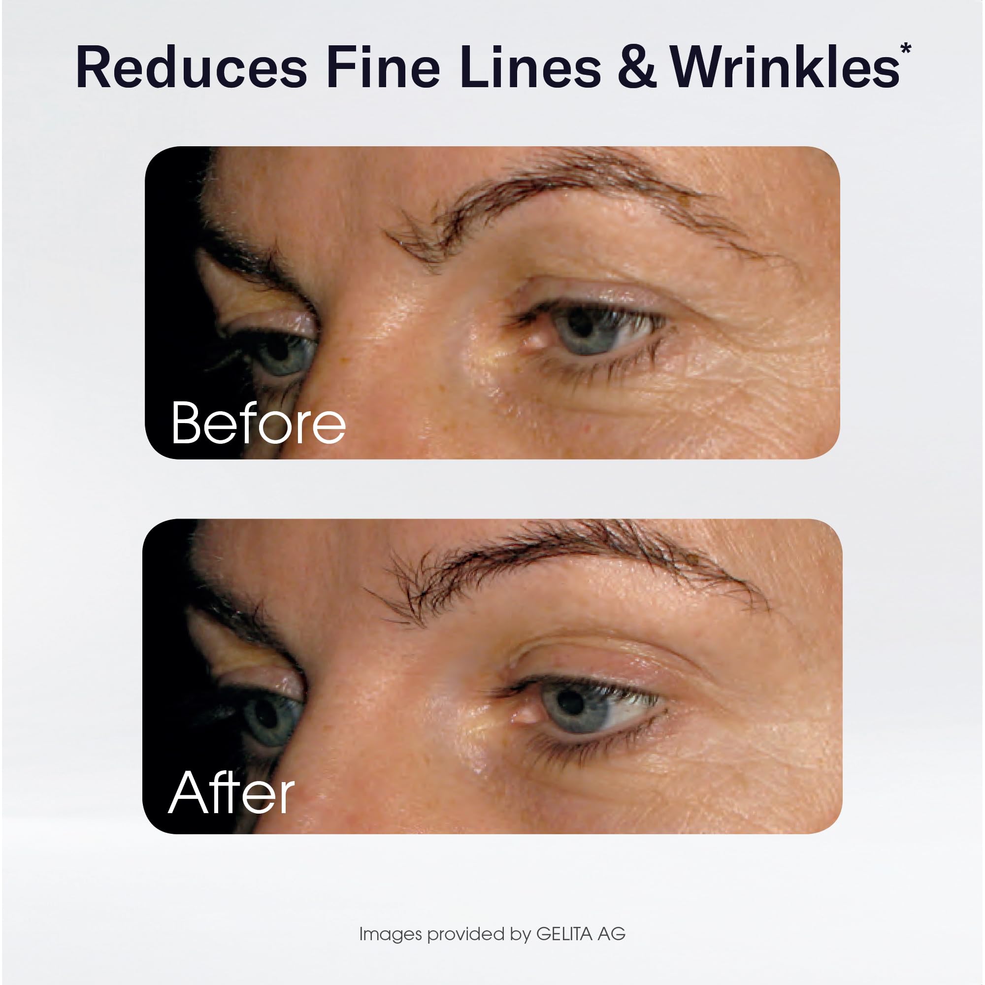 Sparkle Wellness Skin Boost with Vitamin C symbol hints at supporting nutrients.