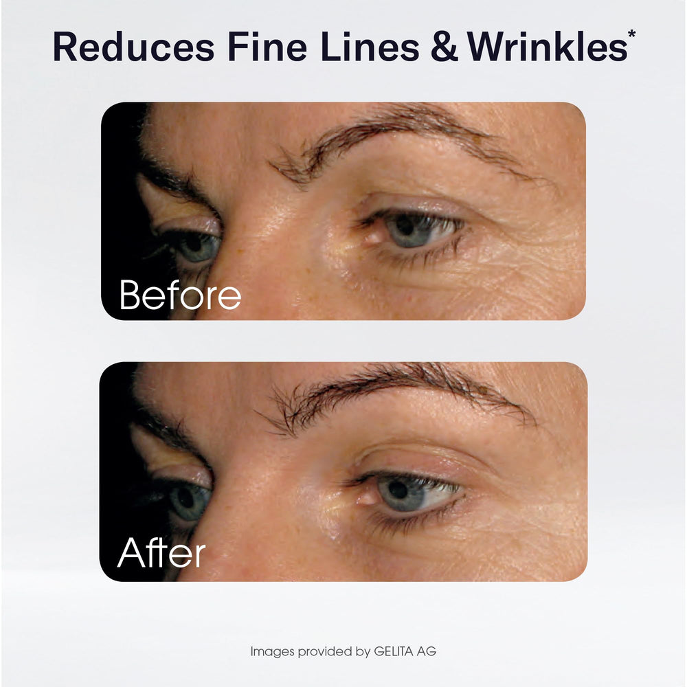 Sparkle Wellness Skin Boost with Vitamin C symbol hints at supporting nutrients.