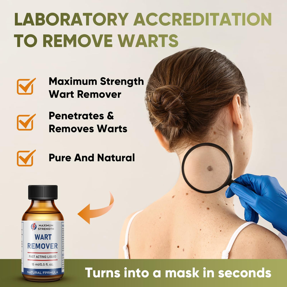 STAY STOKED Wart Remover applicator shown for precise, controlled wart treatment.